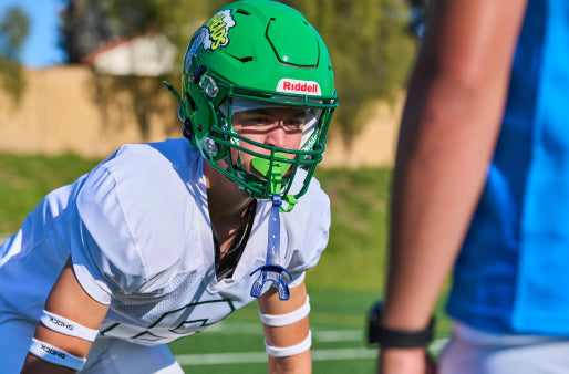 How Mouth Guard Technology Has Evolved Through the Ages